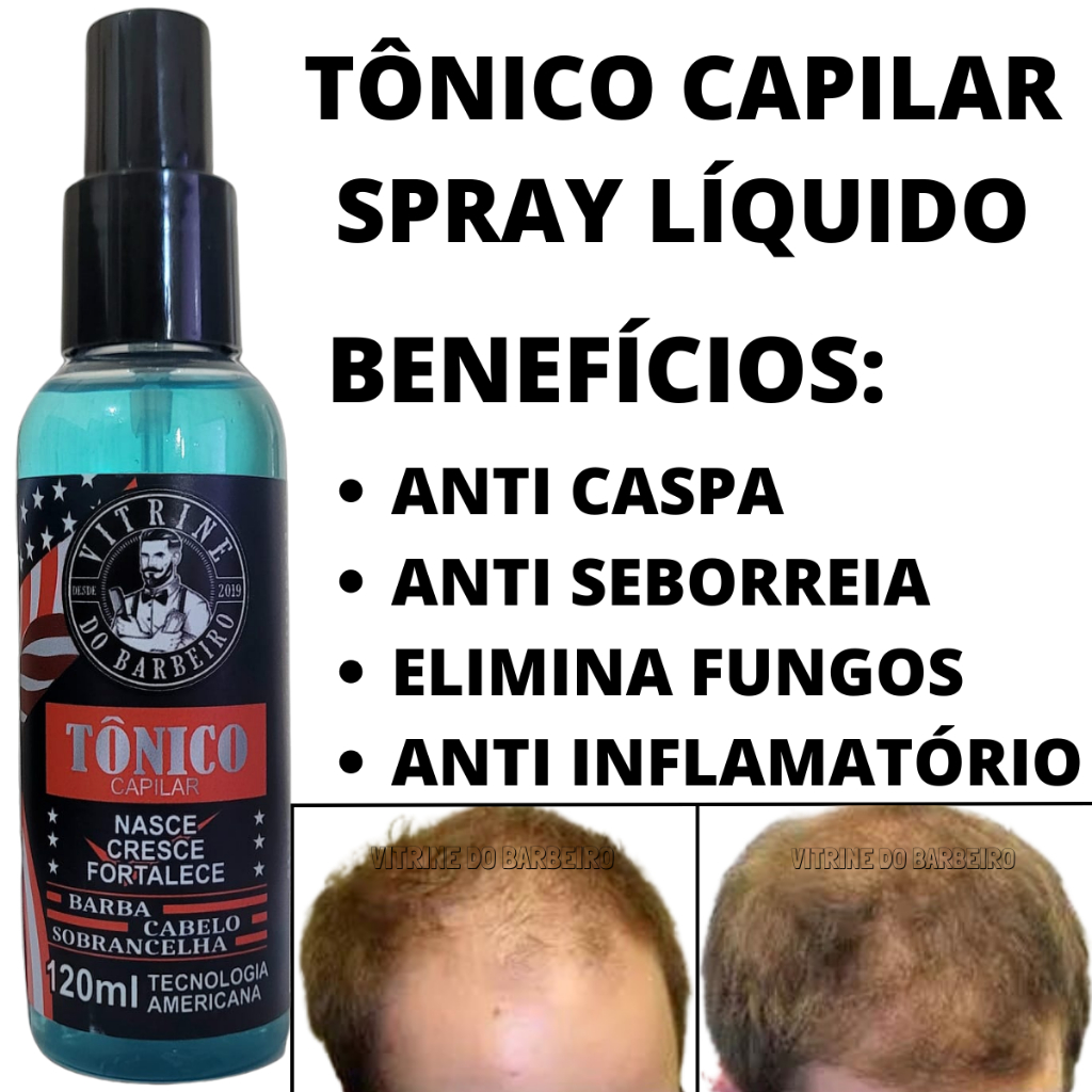 Tônico Para Crescimento Capilar Evita Queda Fibrosante De Cabelo ...