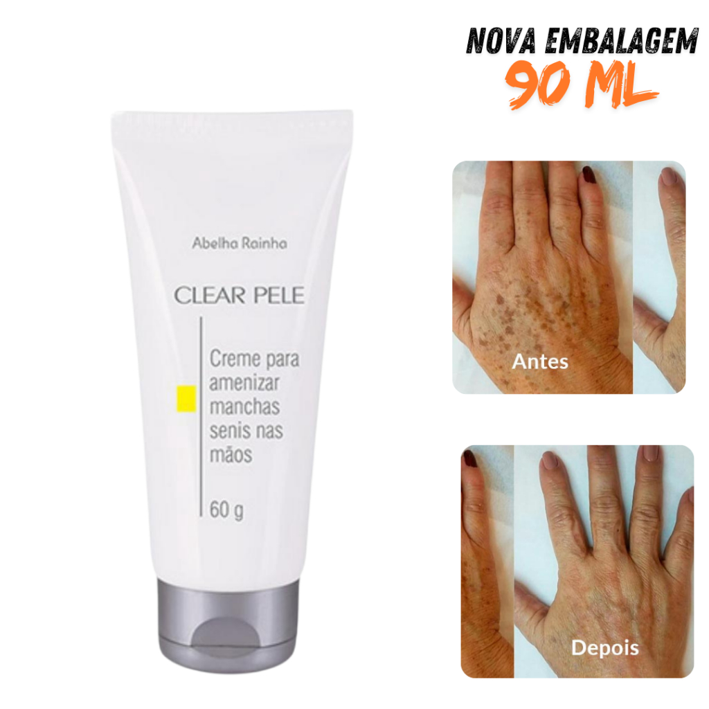 Creme Para Amenizar Marcas e Manchas Nas Mãos Senis Abelha Rainha Clear ...