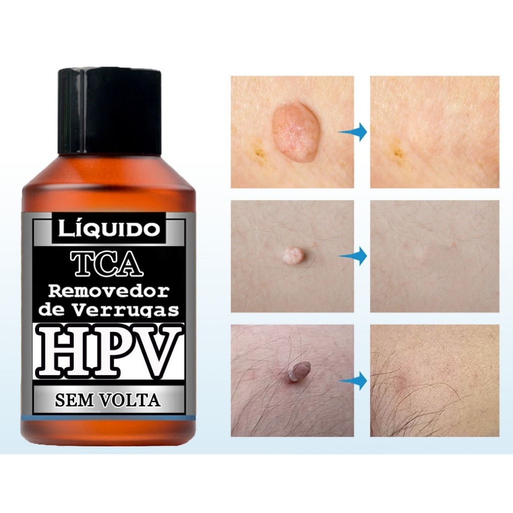 Removedor Rápido (2,5ml) I Envio Rápido no dia a compra