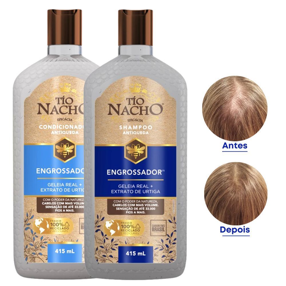 Tio Nacho Antiqueda Shampoo e Condicionador: Onde Comprar | BuscaProdutos