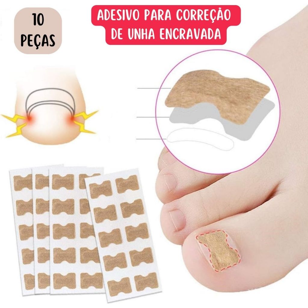 Kit 10 Adesivos Órtose Correção de Unhas Encravadas Manicure Pedicure