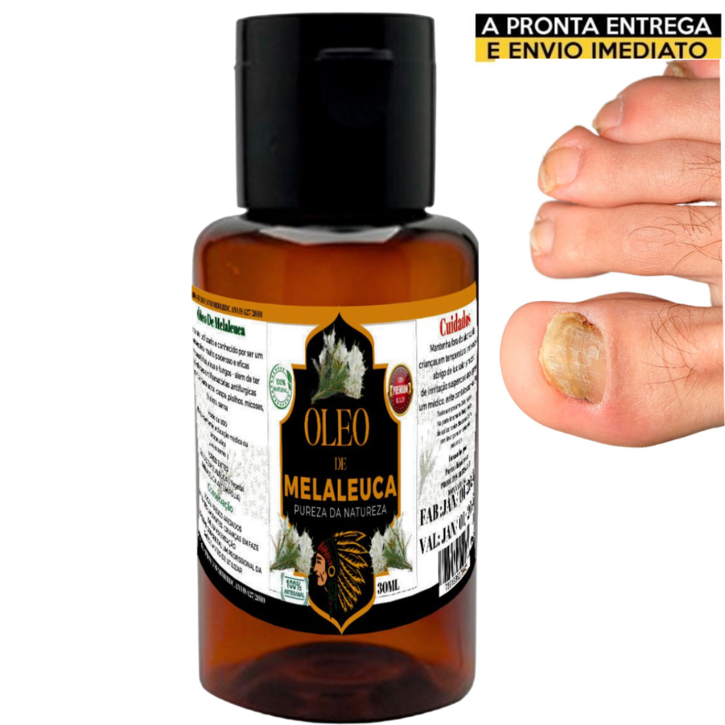 óleo de melaleuca 30 Ml Fortalece A Unha - Pureza Da Natureza | Shopee ...