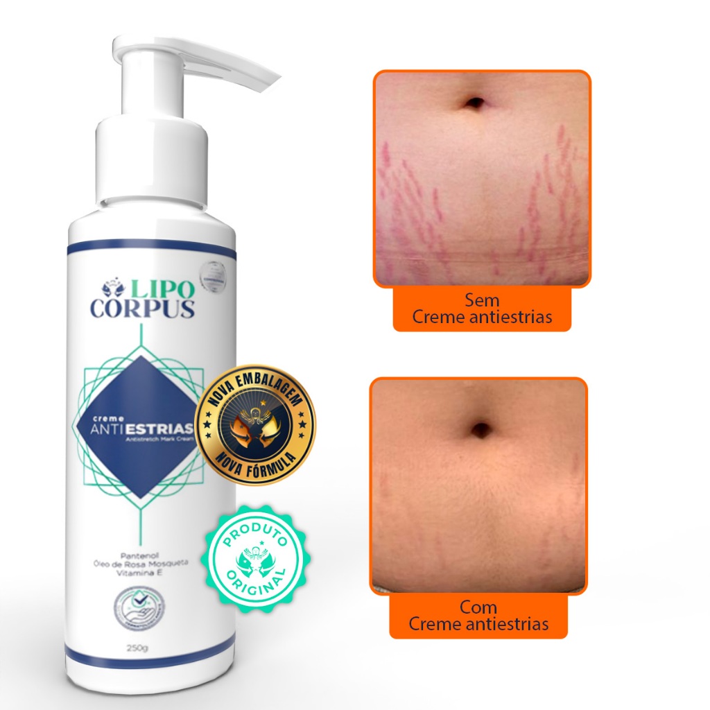 Imagem do produto Creme AntiEstrias Removedor Estrias 250g Lipo Corpus 3