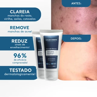 Creme Clareador Dérmico de Manchas para Virilha, Axilas e Melasma 60g - Cicatribem - 2 Unidades