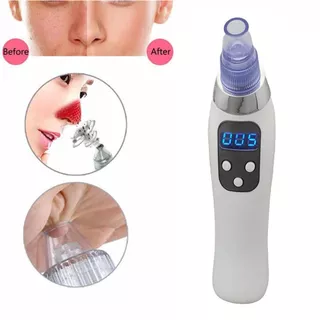 Removedor De Cravos Profissional extrator Acne Espinha Clean - Beleza