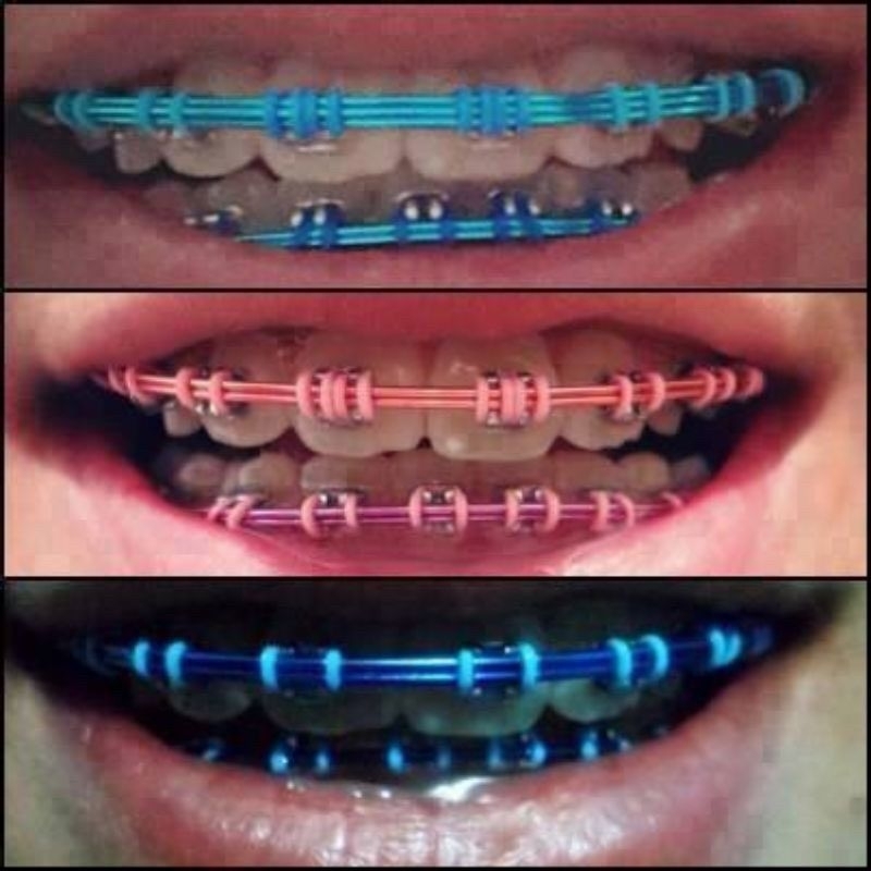 10 Fio Arco Ferrinho Colorido de Aparelho Grossinho (10 unidades)