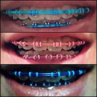 10 Fio Arco Ferrinho Colorido de Aparelho Grossinho (10 unidades)