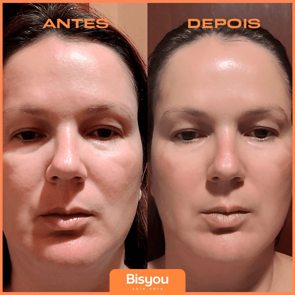 Kit Skin Care Preenchedor Facial e Labial 30g + Hidratante Kit Skin Care Preenchedor Facial e Labial 30g + Hidratante