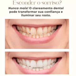 Branqueador Dental de Carvão Ativado