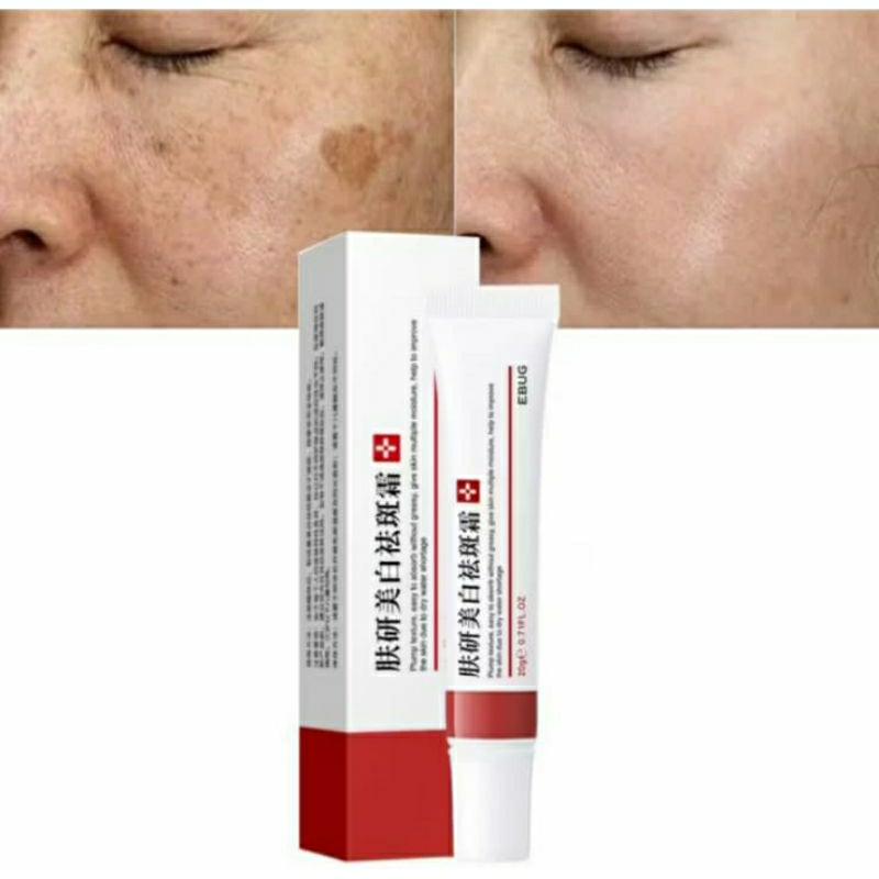 Creme Clareador Para Manchas de Acne e Melasmas Hidratante | Shopee Brasil