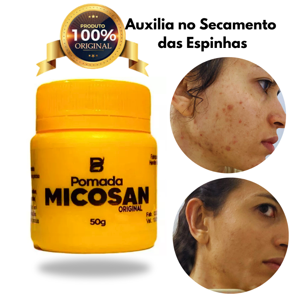 Pomada Micosan Original Creme P/ Micoses, Coceiras Pano Branco Auxilia ...