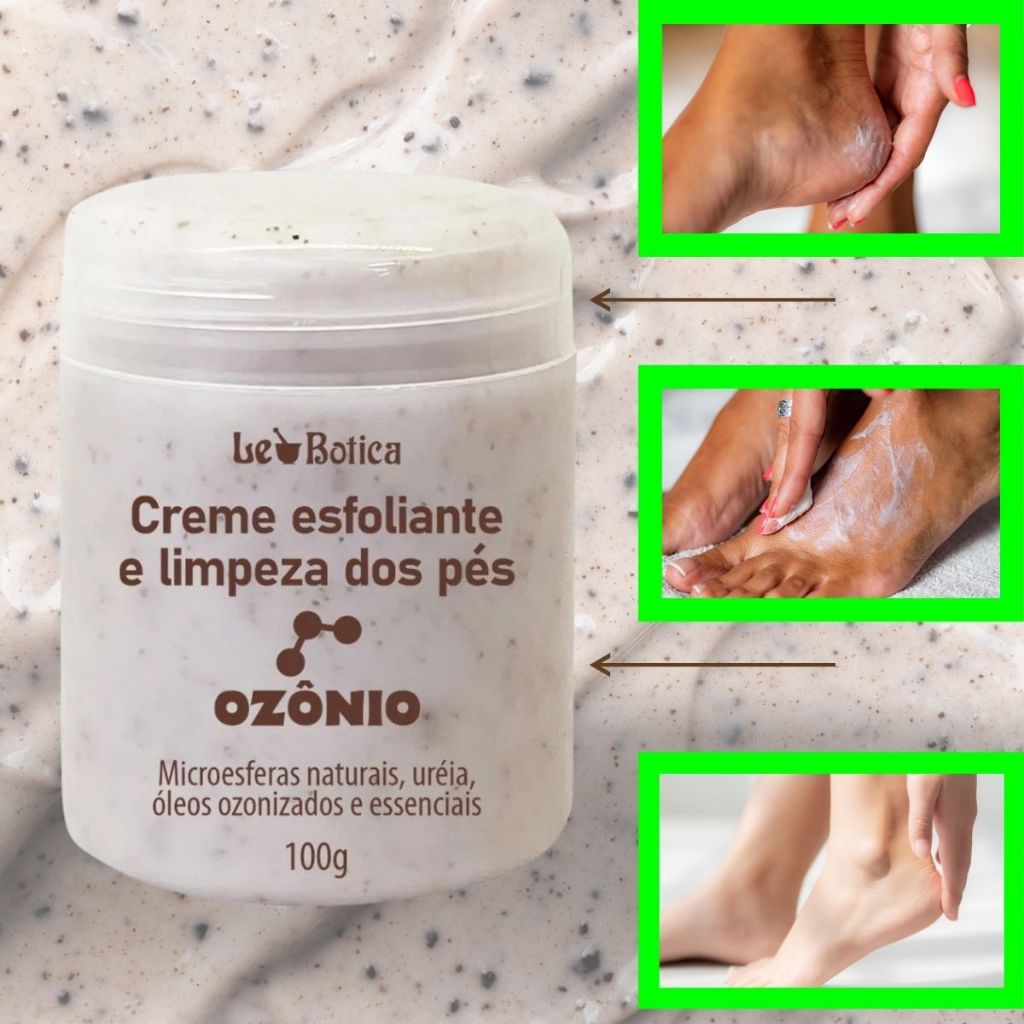Creme Esfoliação para os Pés Rachadura Ozônio com Uréia 100g | Shopee ...