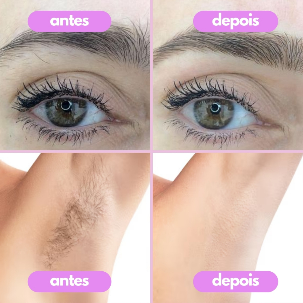 Batom Depilador Facial Elétrico Recarregável Tira Pêlos Buço Sobrancelha  BIVOLT - Envio Imediato