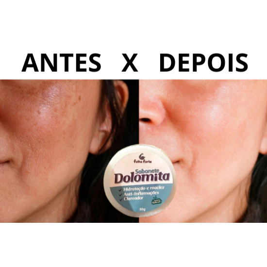 KIT SABONETE CLAREADOR NATURAL DOLOMITA, CLAREIA A PELE, REMOVE ACNE ...