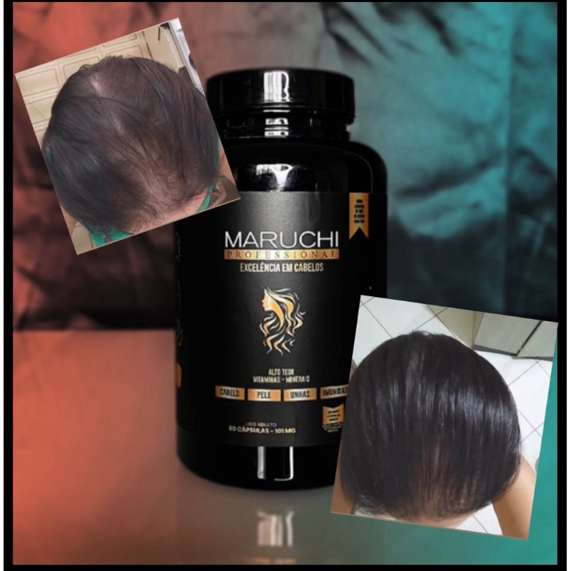 Vitamina Maruchi Hair 60 Cápsulas Tratamento para queda, alopecias e ...