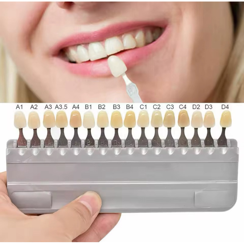 Escala de cores vita, cor de dentes, vitapan classical | Shopee Brasil