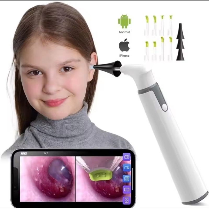 Estetoscópio Profissional c/ Câmera S/ Fio – Tecnologia Avançada para Monitoramento de Pessoas, Animais, Clínicas e vets