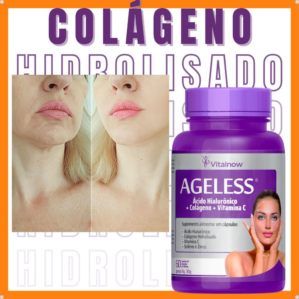 Colágeno Hidrolisado Combate Pele Flacida Estrias Celulite | Shopee Brasil