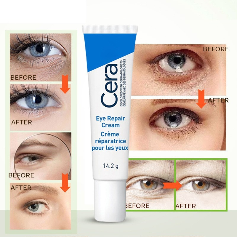 Olhos Para Olheiras Eye Repair Cream Clareador De Olheiras Escuras-14 ...