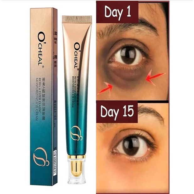O'Cheal Creme Clareador para a área dos olhos Clareador de olheiras ...
