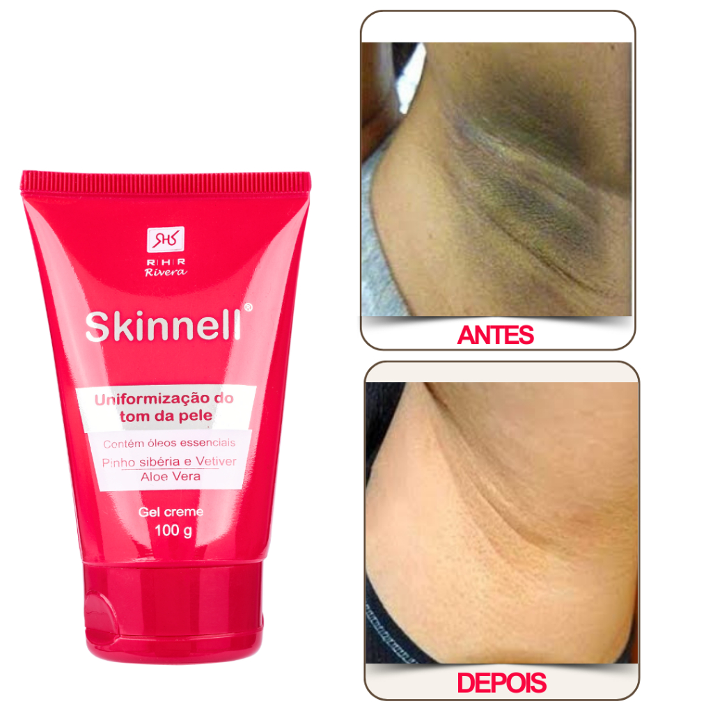 Remédio para Clarear as Axilas - Skinnell 100g | Shopee Brasil