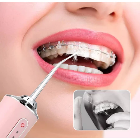 Irrigador Dental Elétrico Oral Portátil Recarregável USB 220ml Limpeza Para família ou viagem