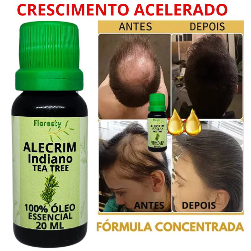Óleo essencial de Alecrim 100% Puro Natural- Crescimento capilar ...