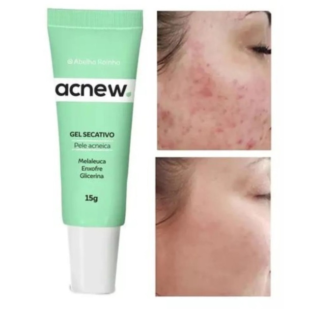 Gel Secativo Cravo E Espinha Acnew Ação Anti-inflamatória Abelha Rainha ...