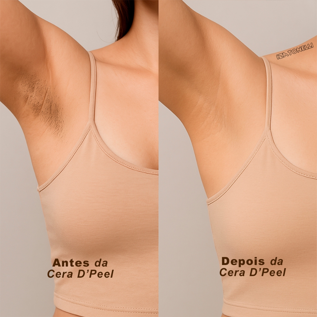 Kit Cera Depilatória 300g Hidrossolúvel Quente Facial Buço