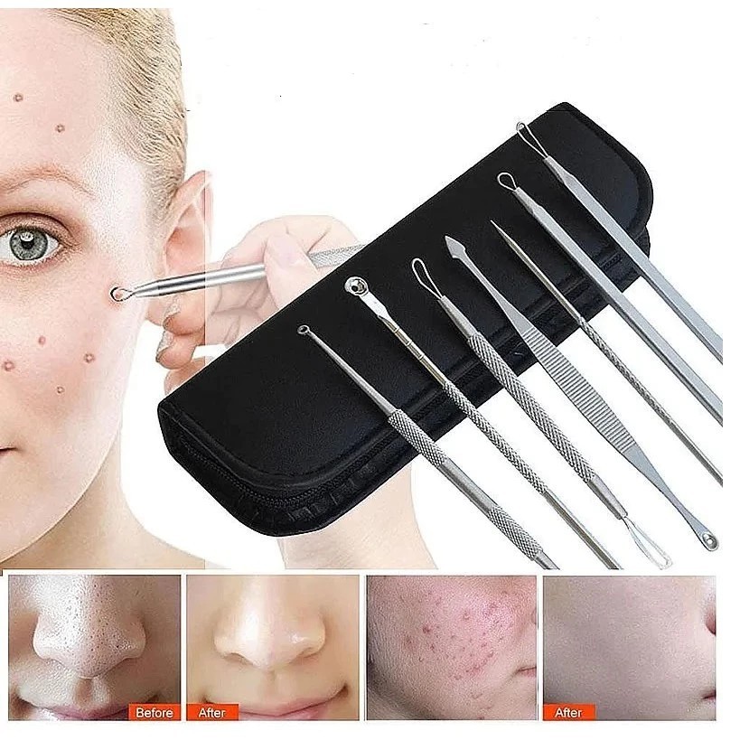 Kit 7 Curetas Remove Cravos Espinhas Aço Inoxidável Com Estojo