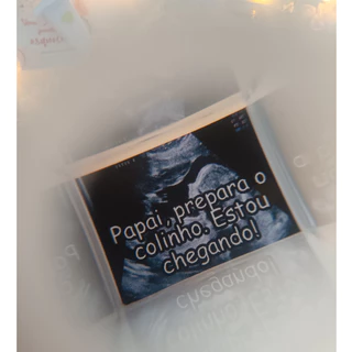 Revelação de gravidez, anuncio de gravidez -  lembrancinha para anunciar a gravidez em Oferta na Shopee