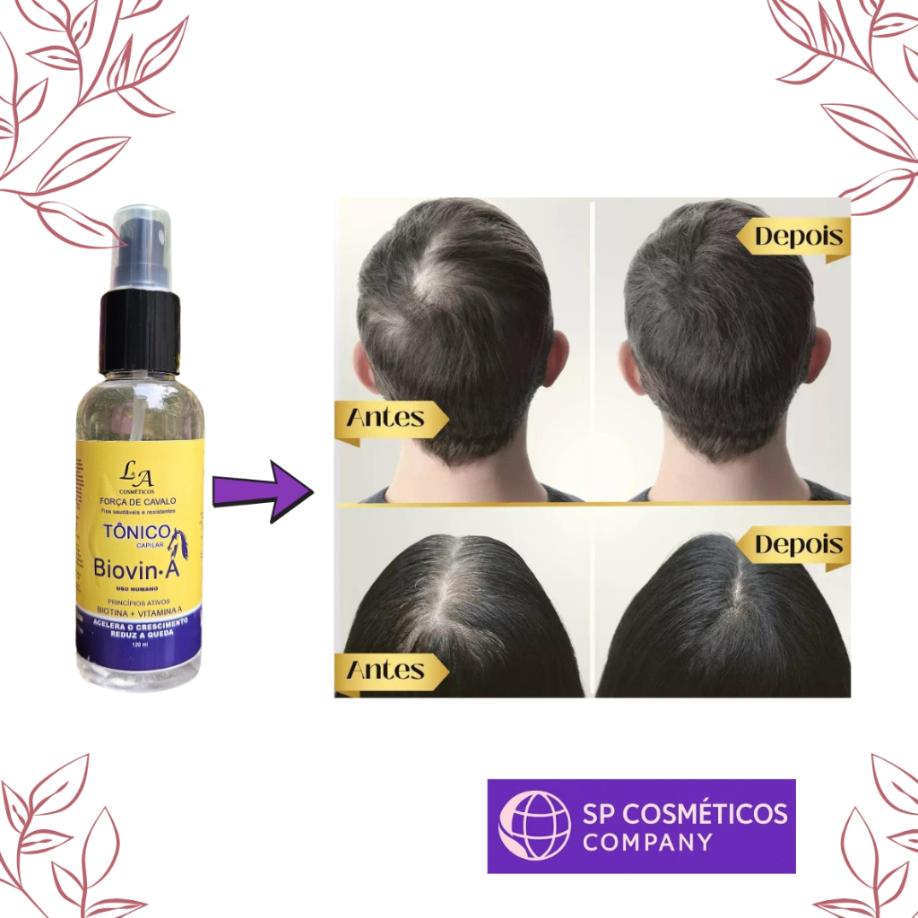 Tônico Capilar para Crescimento e Queda de Cabelo Contem Biotina ...