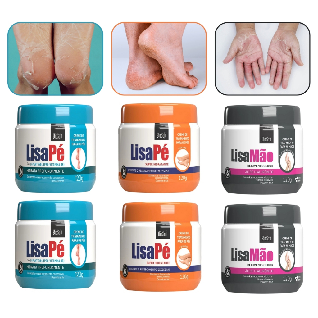 Creme Lisa Hidratante para Pés e Mãos Biosoft 120g com Ácido ...