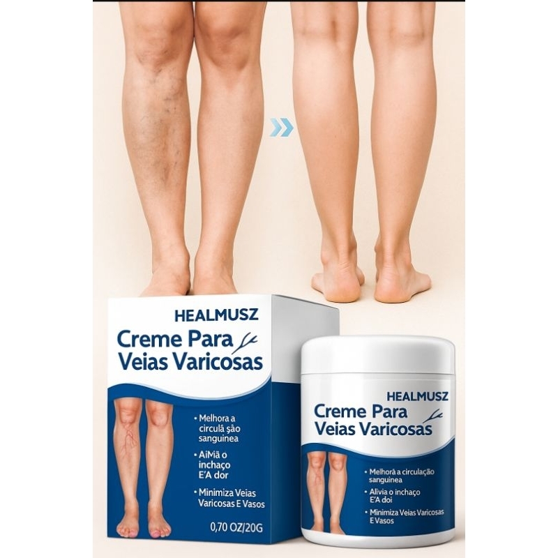 Pomada para varizes HEALMUSZ creme natural para varizes | Shopee Brasil