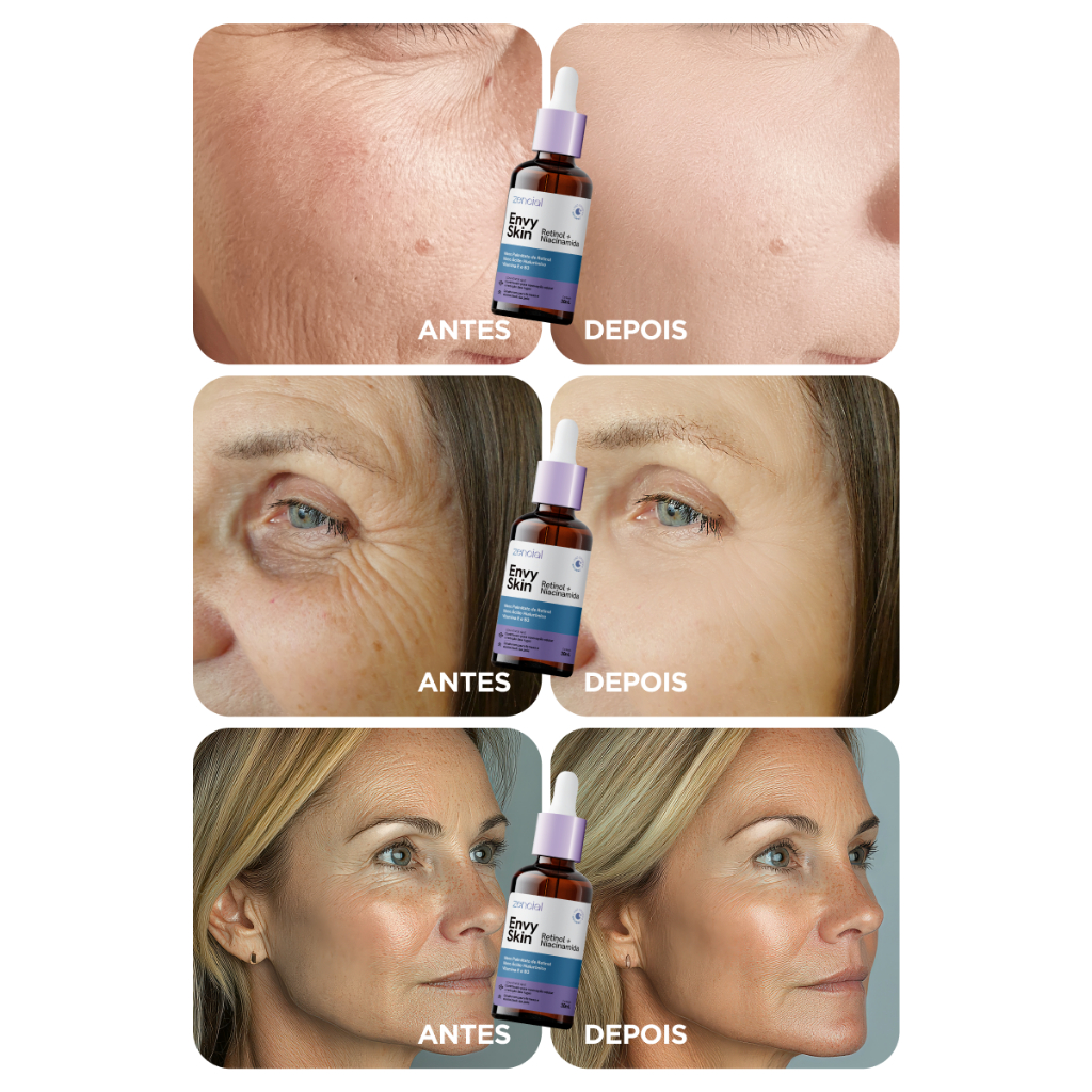 Sérum Zencial Retinol + Niacinamida 30ml | Rejuvenescedor e