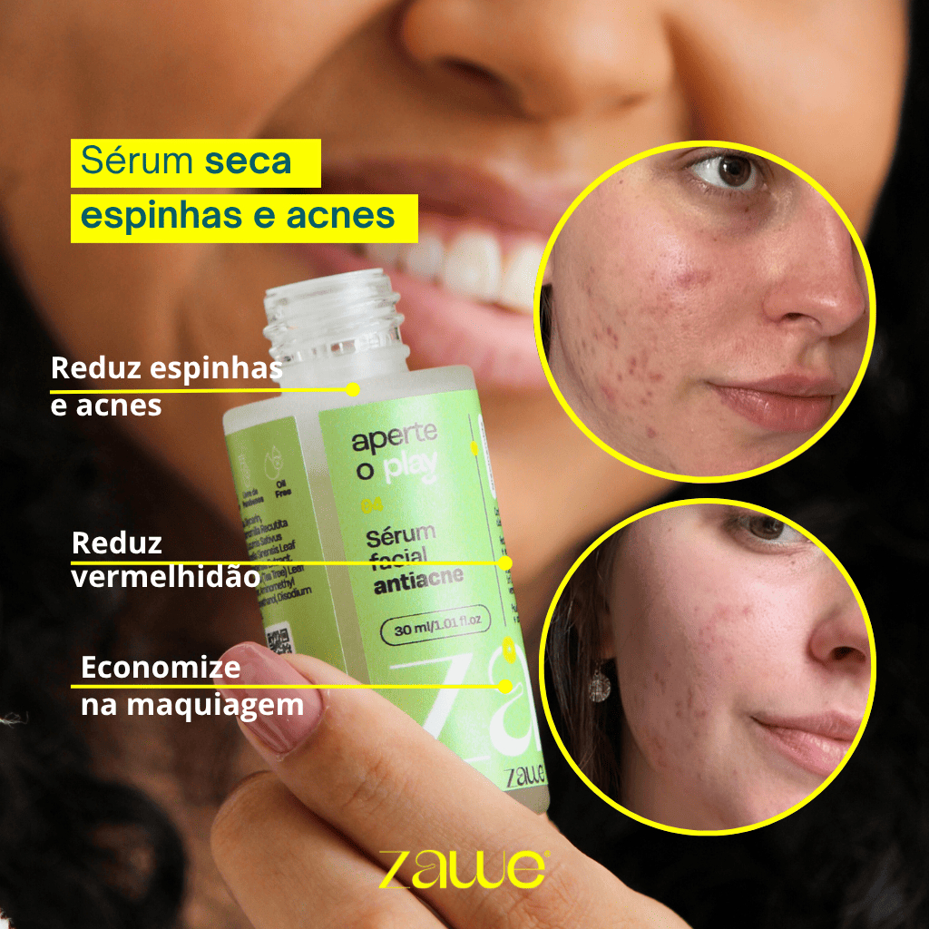 Kit Antiacne Completo Skincare Pele Mista e Oleosa Espinhas com