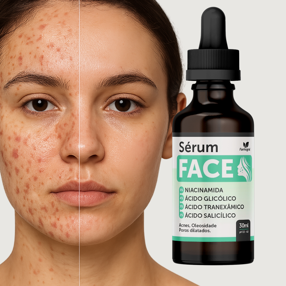 Sérum Clareador de Manchas Facial Cravos e Espinhas - 30ml - Envio ...