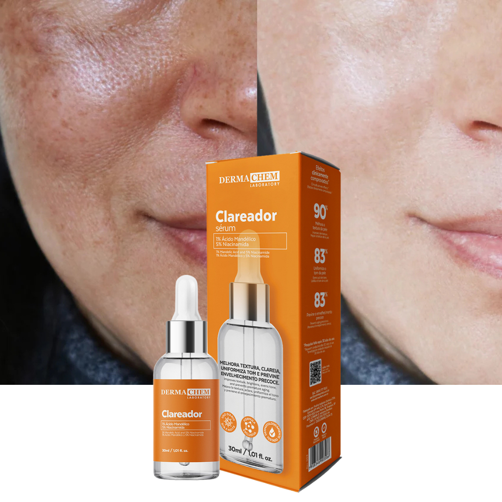 Sérum Clareador Dermachem de Melasma Uniformiza o tom da Pele Clareia Manchas Clareador Niacinamida