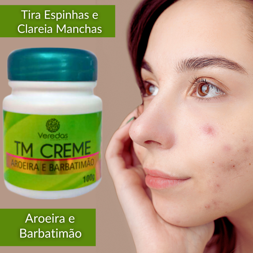 Creme Facial Seca Espinha e Tira Manchas e Aroeira e Barbatimão ...