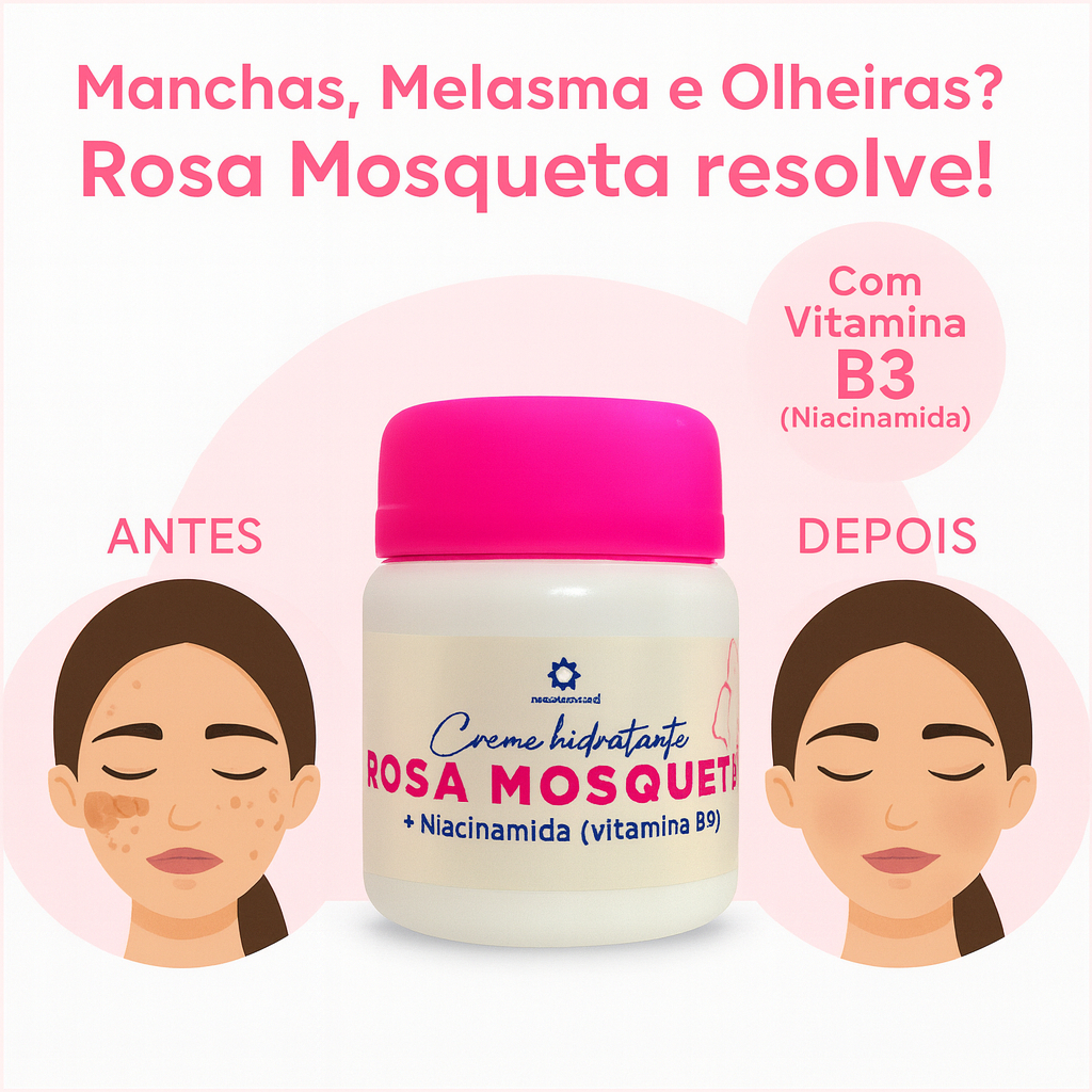 Creme Rosa Mosqueta + Niacinamida | Adeus Manchas, Melasma e Olheiras ...