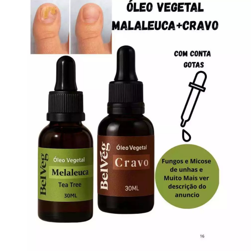 Kit óleo Melaleuca + Cravo 30ml Cada - Fungos e Micose de unhas e Muito ...