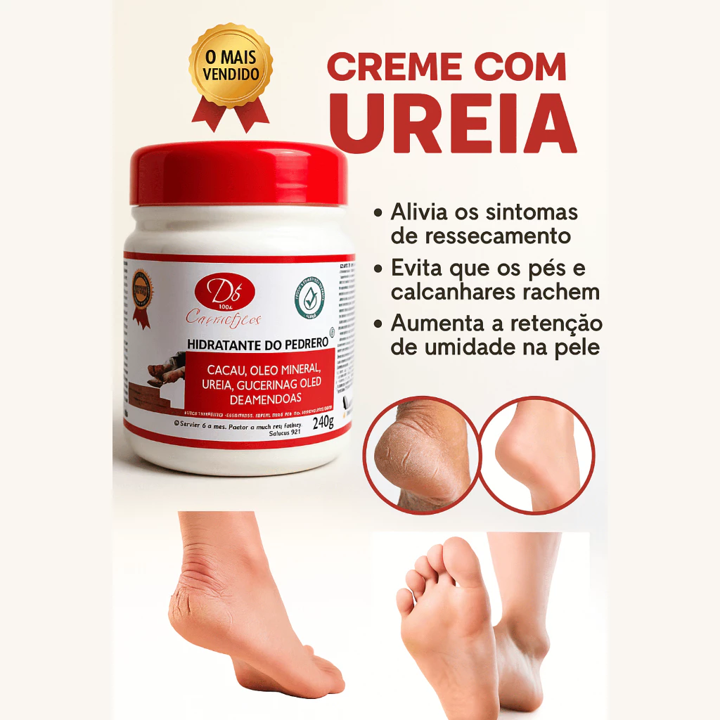 Creme do Pedreiro com Ureia – Hidrata e Amacia Pés e Mãos | Tamanhos 30g a 500GR Nª -1 PRA RACHADURAS