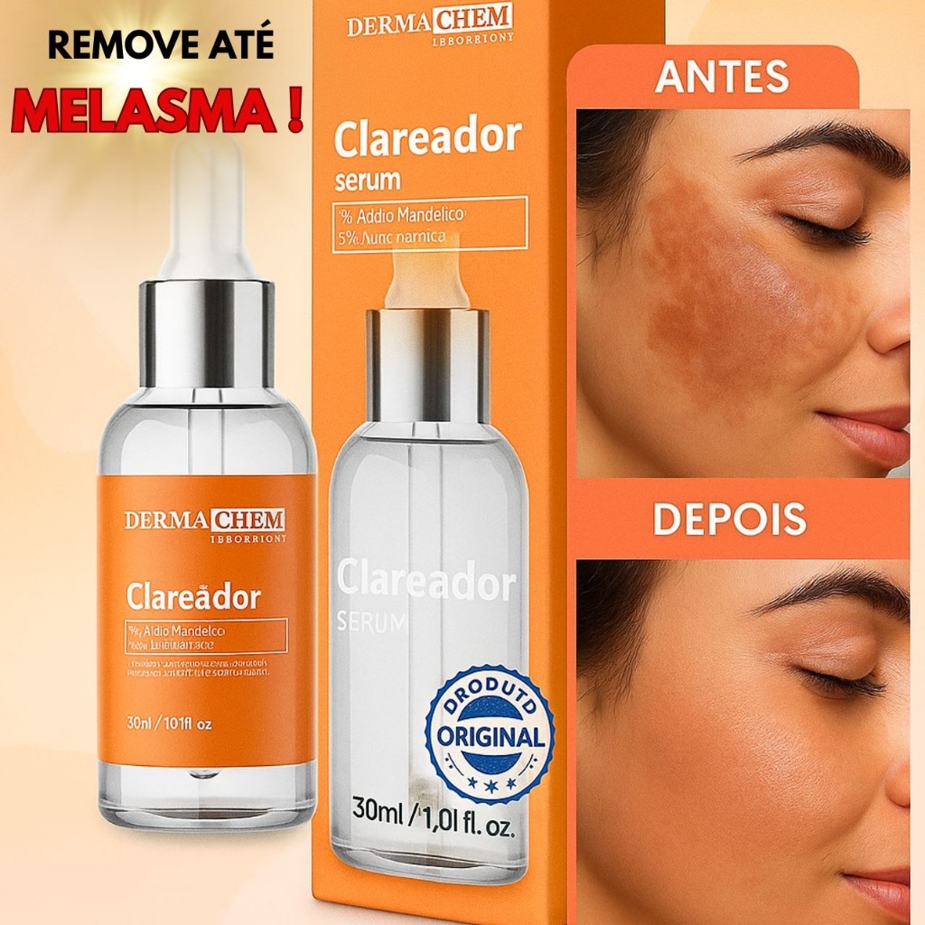 Sérum Clareador de Melasma Dermachem Clareia Manchas -30ml | Shopee Brasil