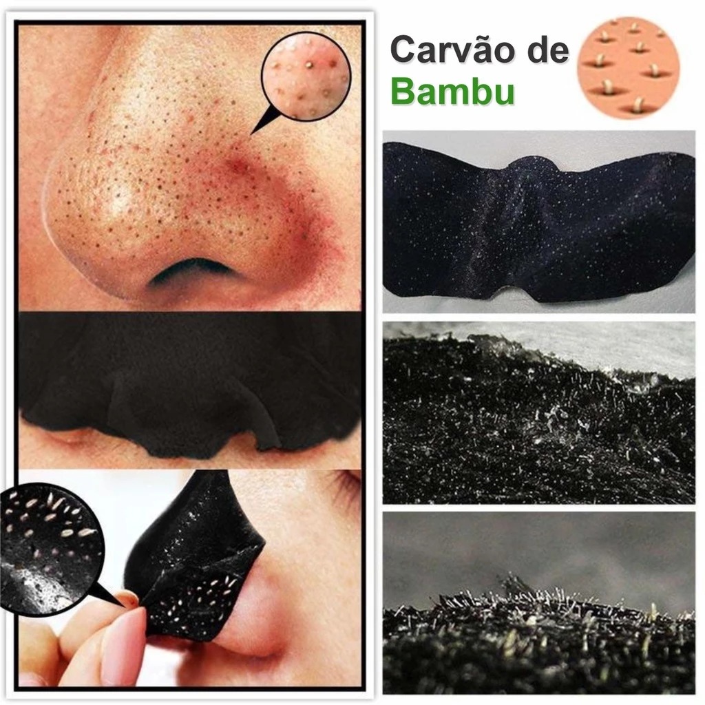 Adesivo Removedor de Cravos e Espinhas Para Nariz 5/10/20/30 Unidades ...