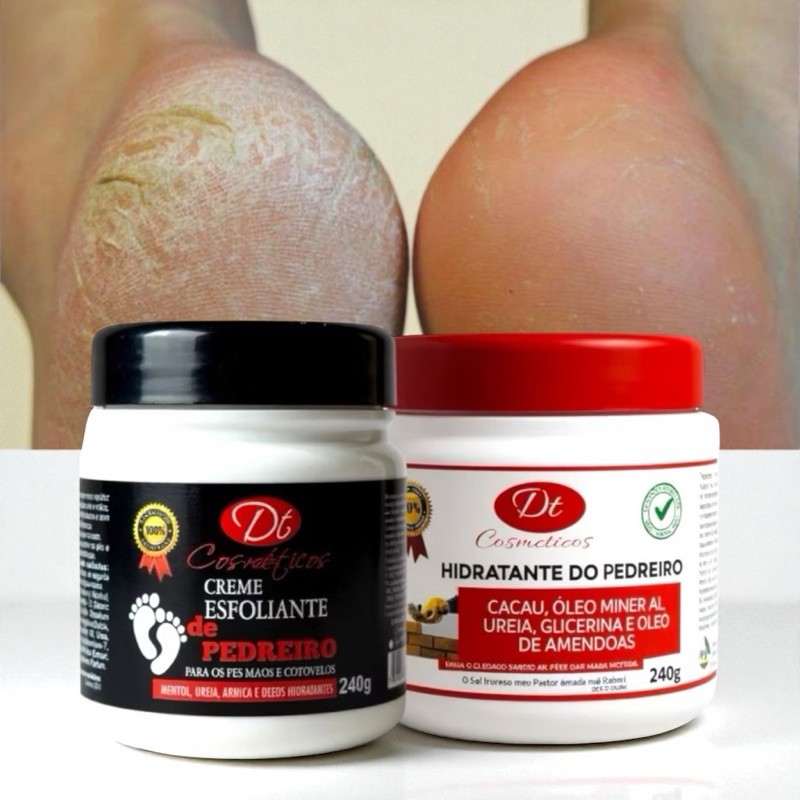 Kit para Pé rachado Ressecado Grosso Pele Áspera Spa dos pés 1 Creme ...