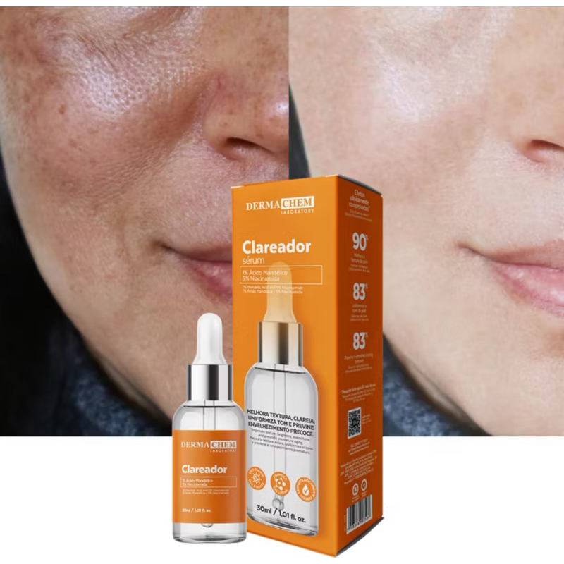 Sérum Clareador de Melasma Uniformiza o tom da Pele Clareia Manchas ...