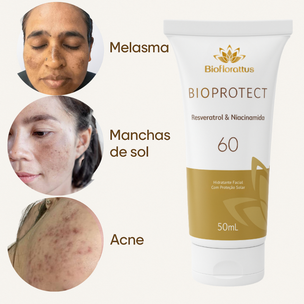 Protetor Solar Facial | Melasma, Manchas De Sol, Acne – FPS 60 Toque ...