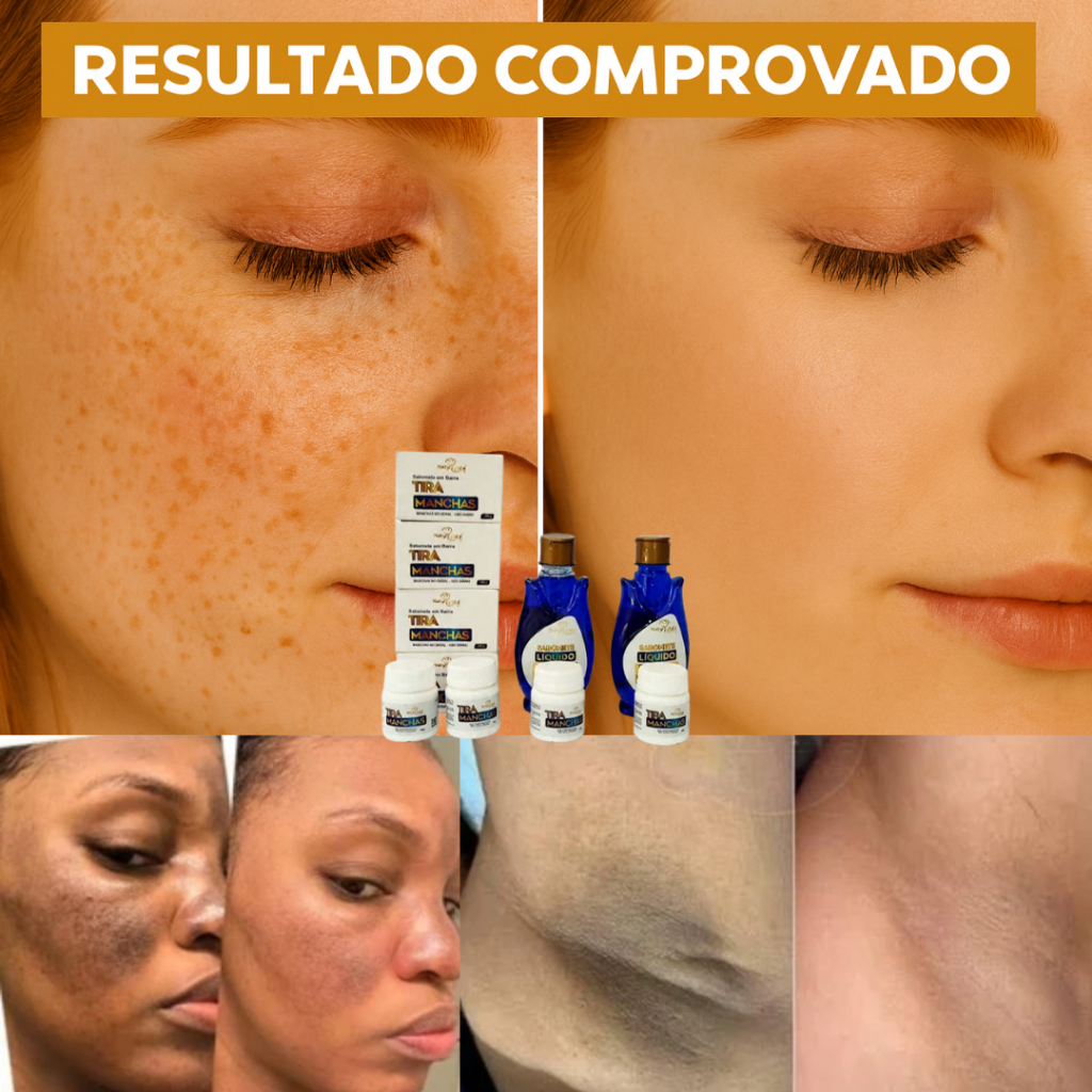Kit Clareador Natyflora 10 Unidades – Auxilia no Cuidado de Manchas e ...