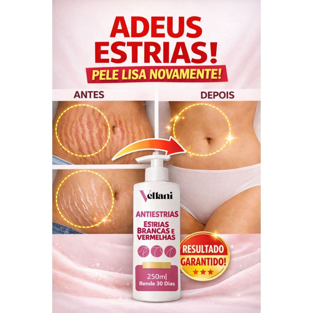 Creme Antiestrias Vellani 250ml – Estrias Antigas e Novas – Gestante ...
