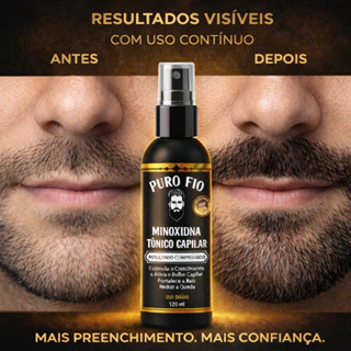 Kits de PRO BARBER Tônico Capilar antiqueda 1 a 5 unidades 120ml Crescimento Cabelo Barba Sobrancelha Envio Imediato